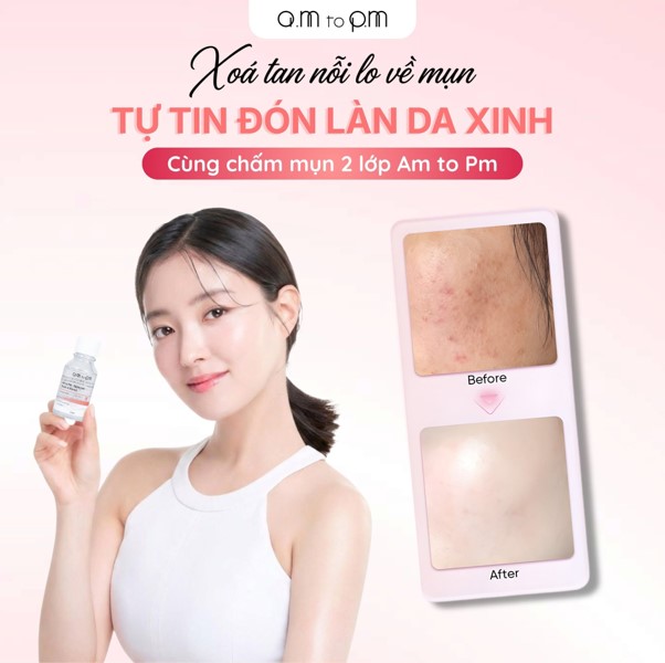 Chỉ một nốt mụn sưng đỏ xuất hiện trước ngày đi du lịch, chụp ảnh kỷ yếu hay tham dự một sự kiện quan trọng cũng đủ khiến nhiều phụ nữ mất tự tin. Chính vì vậy, các giải pháp xử lý mụn nhanh nhưng vẫn đảm bảo an toàn cho làn da đang trở thành xu hướng được nhiều người quan tâm trong mùa hè 2026.